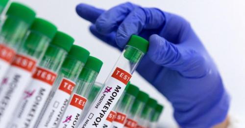 Mpox Global Health Emergency: Symptoms, Spread, Prevention